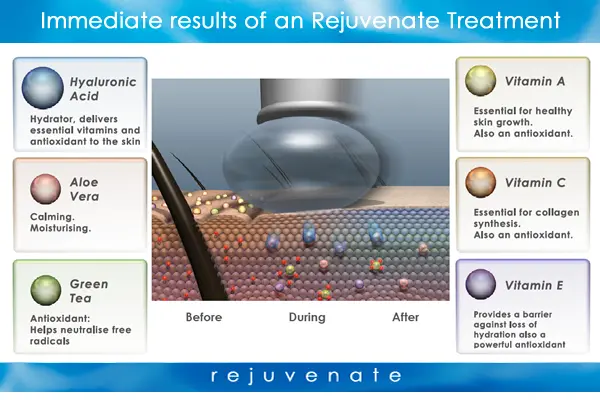 tratamente intraceuticals oxigen pete pigmentare 5