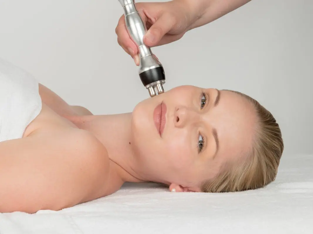 tratamente radiofrecventa antirid faciale 2